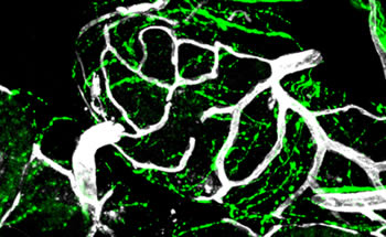 This image shows tissue from an early-stage tumor developing in a mouse model of prostate cancer. Sympathetic-nerve fibers (green) are closely intertwined with blood vessels (white). Norepinephrine released by nerve fibers stimulates vessel proliferation that fuels tumor growth.