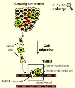 Metastasis requires the presence of three cells in direct contact on a blood vessel wall: a tumor cell that produces the protein MENA; a peri-vascular macrophage (cells that guide tumor cells to blood vessels); and a blood-vessel endothelial cell. The presence of three such cells in contact with each other is called a tumor microenvironment of metastasis, or TMEM, which is depicted within the box in this illustration.