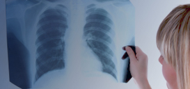Girl's Life Saved by Novel Therapy for Drug-Resistant TB